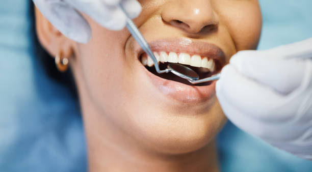 Best Cracked Tooth Emergency Dentist  in Ava, MO
